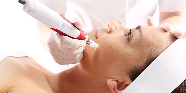 Microneedling